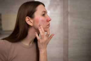 Dermatologist Recommended Skin Care Routine for Rosacea