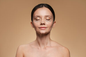 How to Get Rid of Beauty Marks