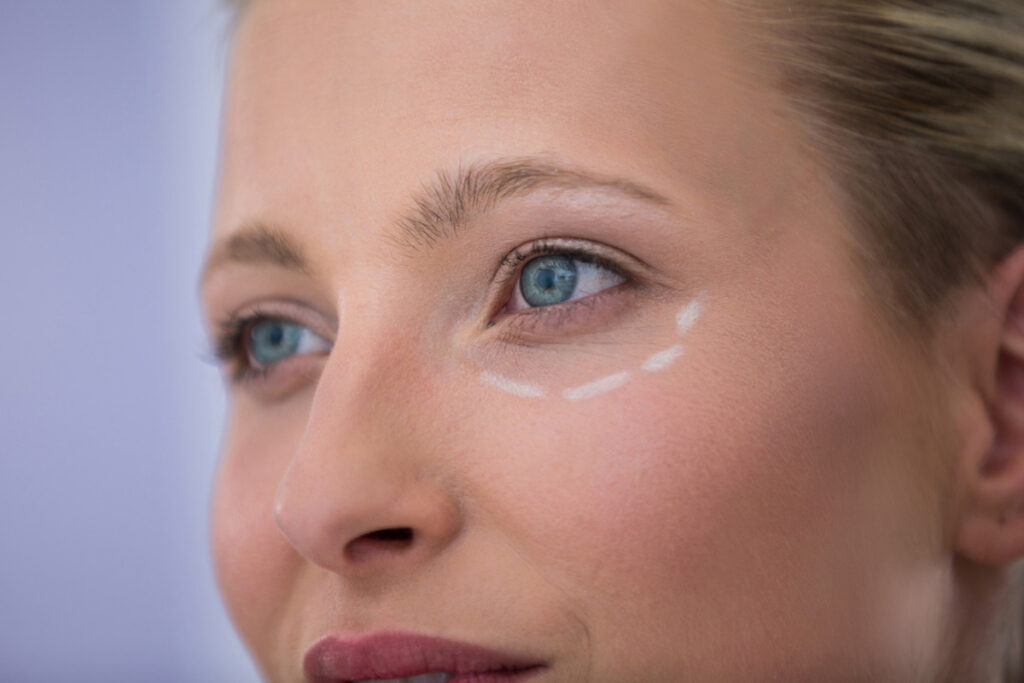 Thin Skin Around Eyes