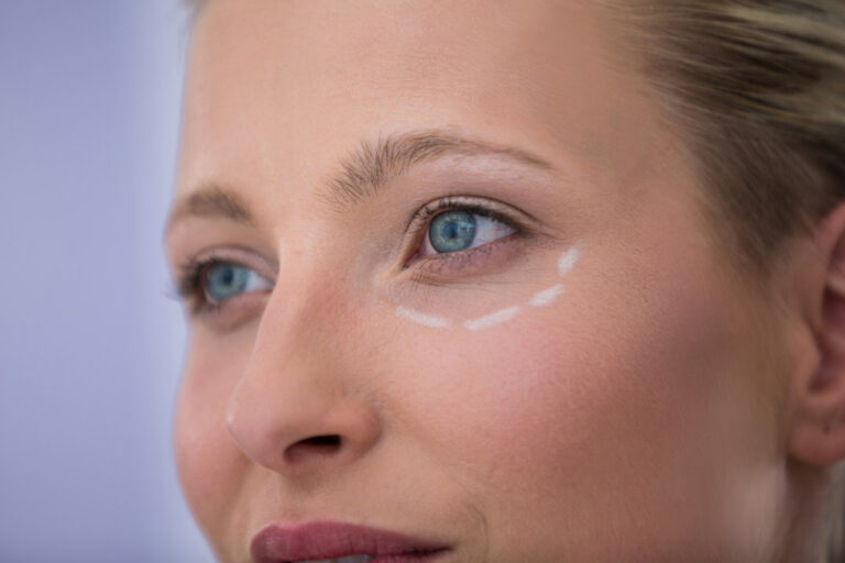Thin Skin Around Eyes